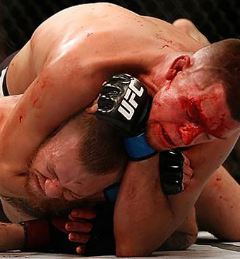 Stockton's Nate Diaz Beats Connor McGregor At UFC 196